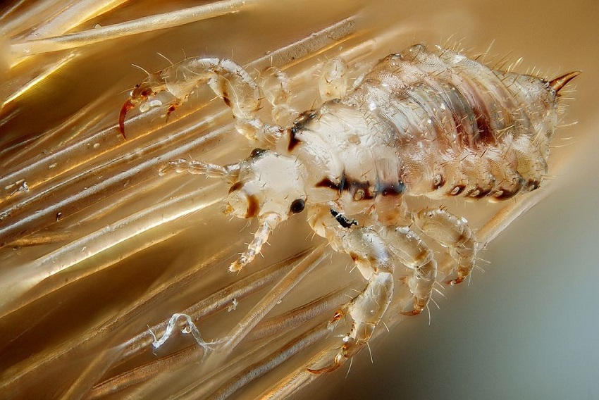 Will Clove Oil Kill Lice